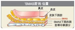 什么是“SAMS”